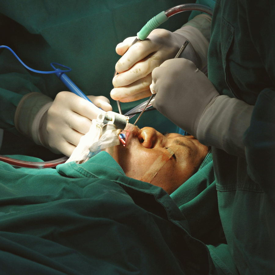 General Surgery